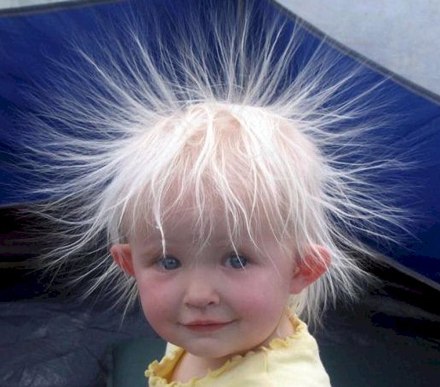 kid-with-static-hair